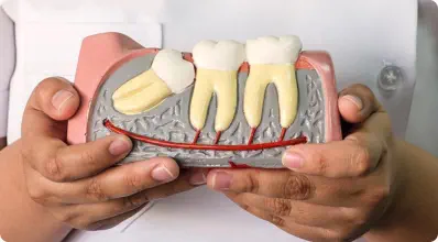 Gum disease treatment Cedar City

